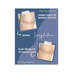 La Saponaria Siero Urto Smagliature 100ml -Offerte Cosmetici Negozio doccia shampoo barca mare camp 984520027 1 4 1668417434